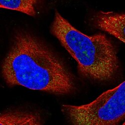 RPL13A Antibody, Novus Biologicals 0.1mL; Unlabeled:Antibodies, Polyclonal